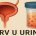 krv u urinu
